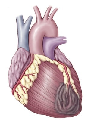 Heart on Inspiyr Com   5 Surprising Heart Attack Triggers